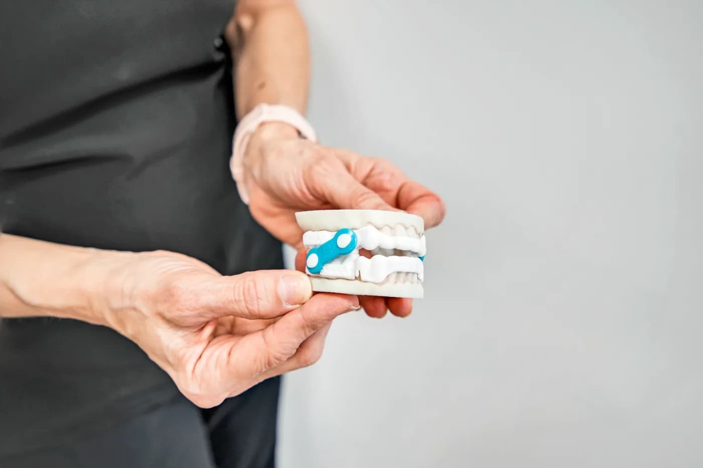 SERENA oral sleep appliance demonstrated on a dental model